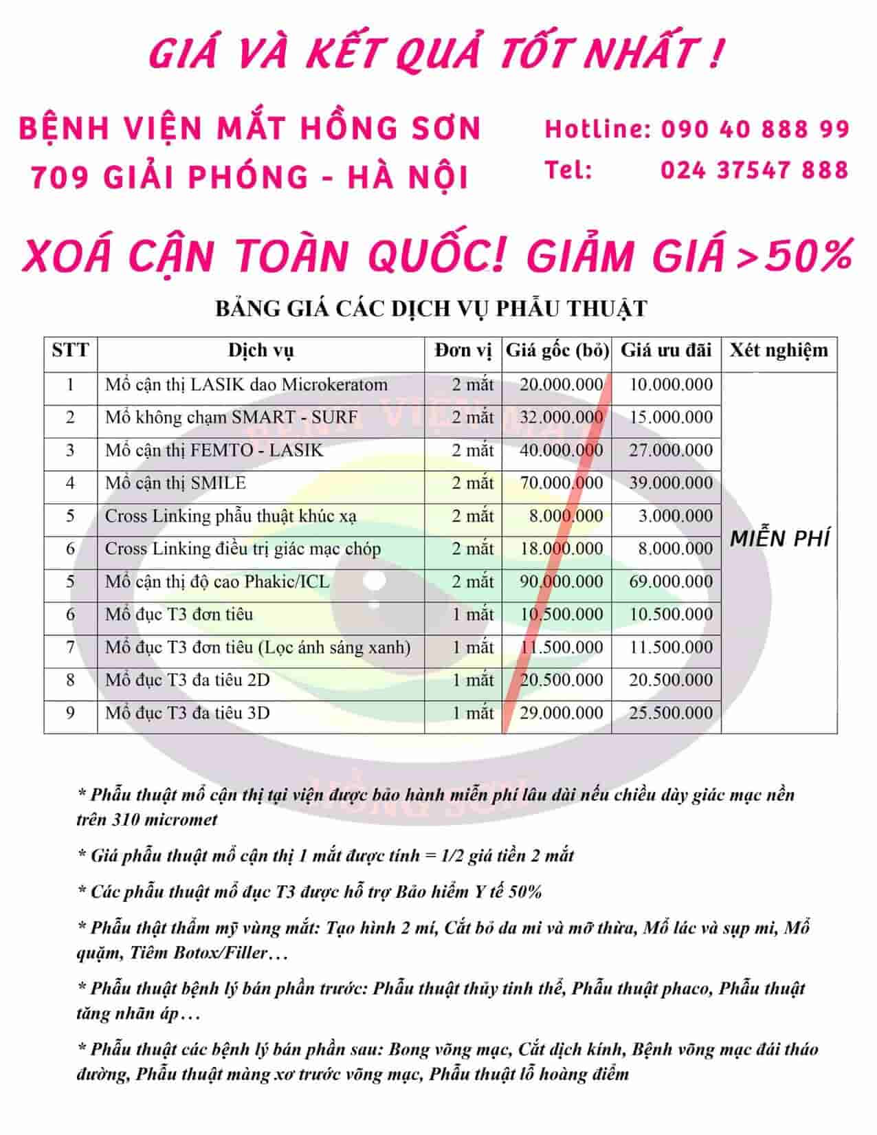 Bảng giá mổ cận