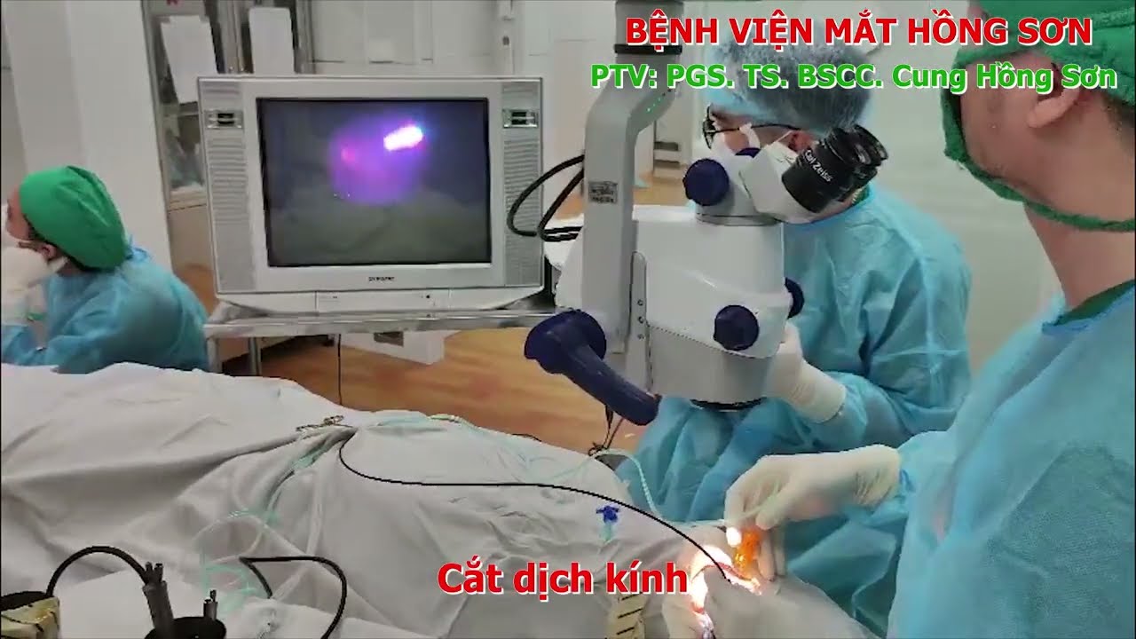 Bóc màng ngăn trong điều trị lỗ hoàng điểm (Internal Limiting Membrane Peeling for Macular Holes)