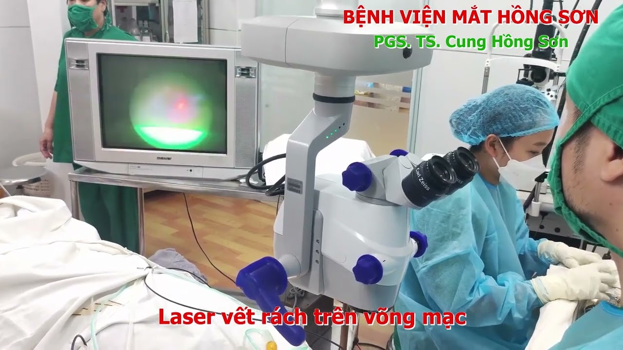 PHẪU THUẬT PHACO VÀ CẮT DỊCH KÍNH ĐIỀU TRỊ BONG VÕNG MẠC